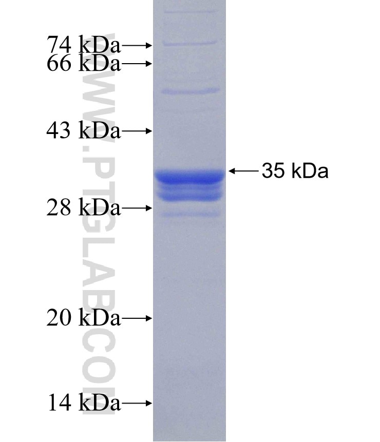 ALG9 fusion protein Ag30489 SDS-PAGE