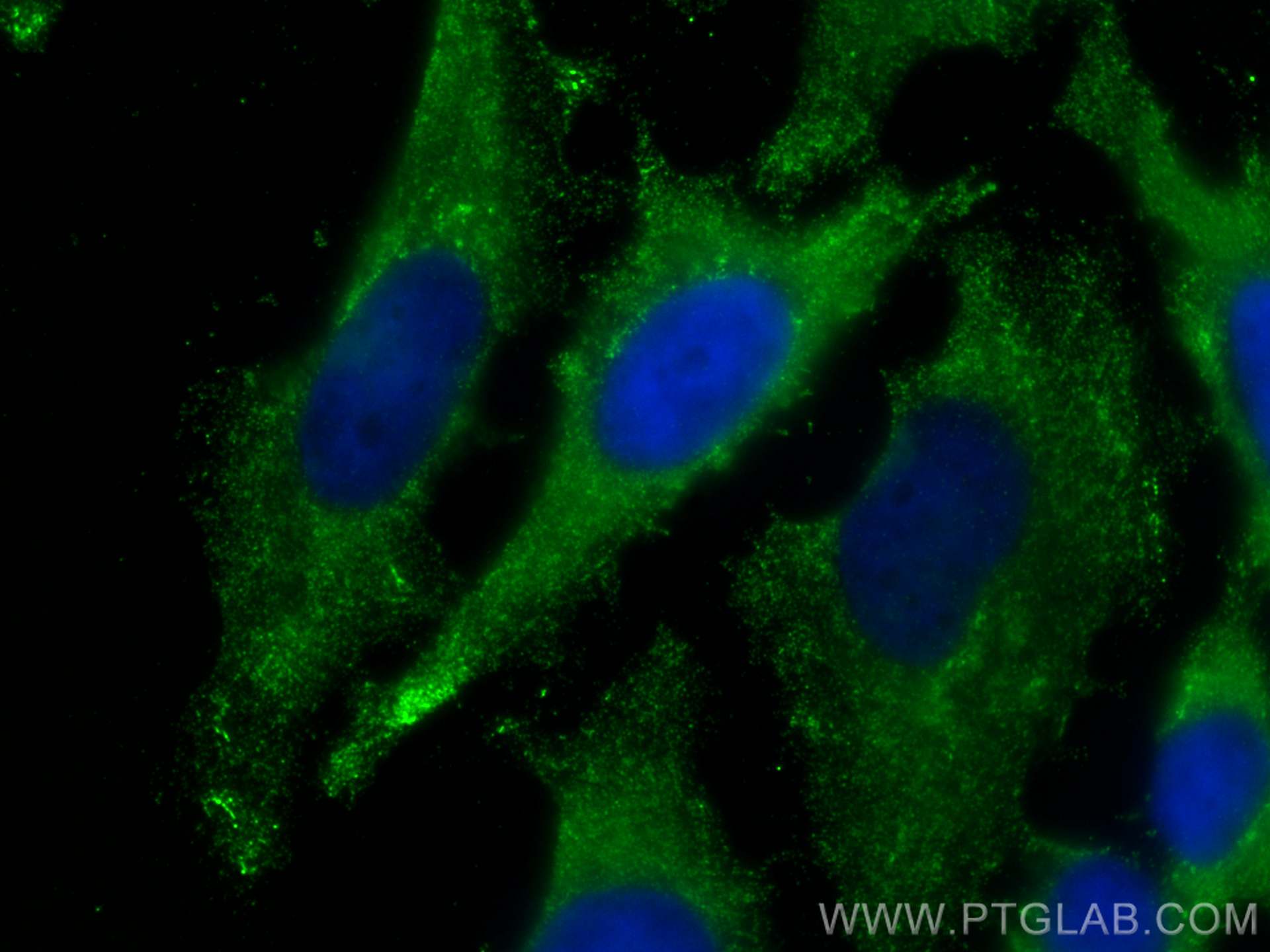 Immunofluorescence (IF) / fluorescent staining of HeLa cells using Alix Monoclonal antibody (67715-1-Ig)