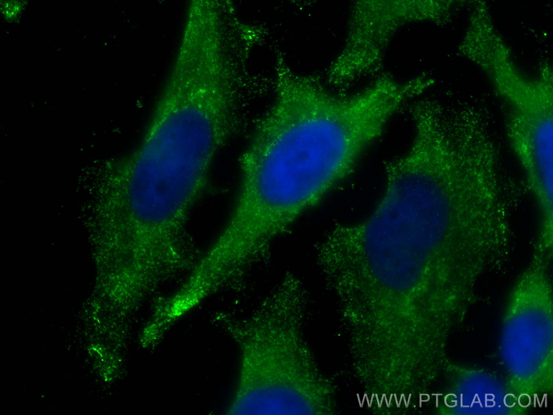 IF Staining of HeLa using 67715-1-Ig