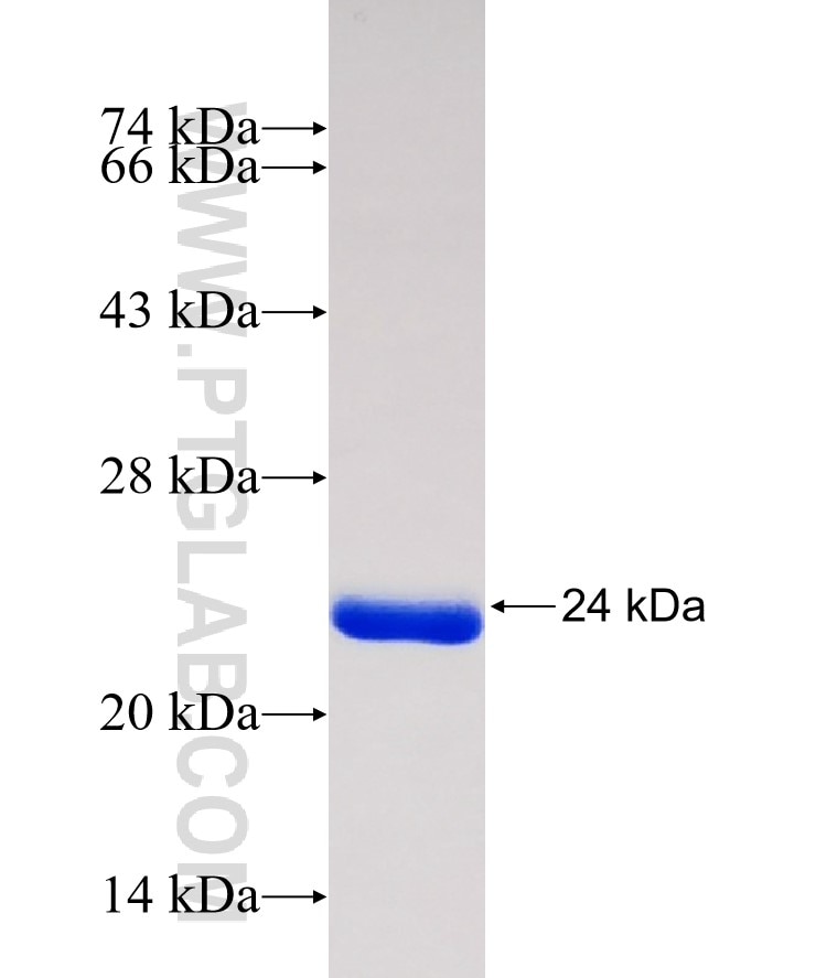 ALIX; AIP1 fusion protein Ag30437 SDS-PAGE