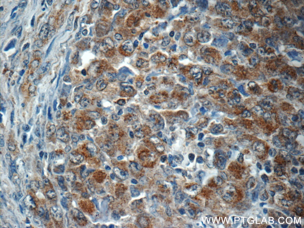 ALK Polyclonal antibody