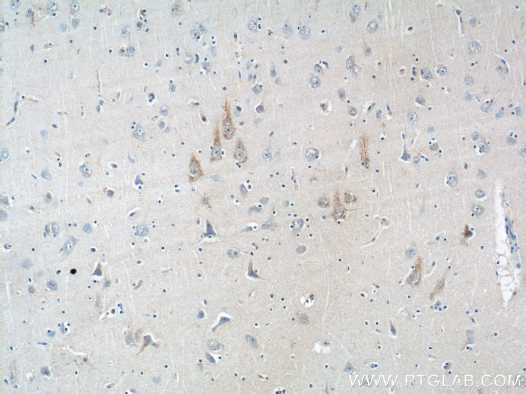 Immunohistochemistry (IHC) staining of human brain tissue using ALK Polyclonal antibody (24184-1-AP)