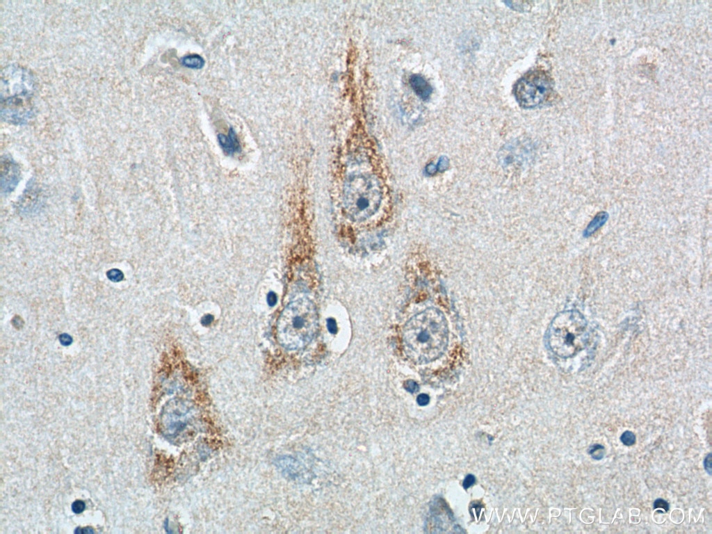 Immunohistochemistry (IHC) staining of human brain tissue using ALK Polyclonal antibody (24184-1-AP)