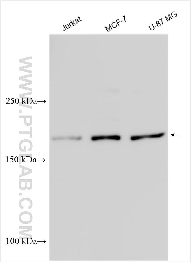 Western Blot (WB) analysis of various lysates using ALK Polyclonal antibody (24184-1-AP)