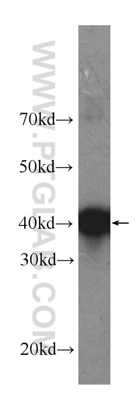 Western Blot (WB) analysis of Recombinant protein using ALK Monoclonal antibody (60321-1-Ig)