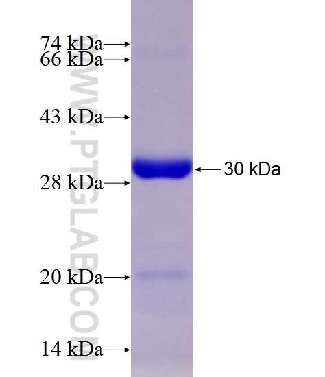 ALK,CD246 fusion protein Ag28482 SDS-PAGE
