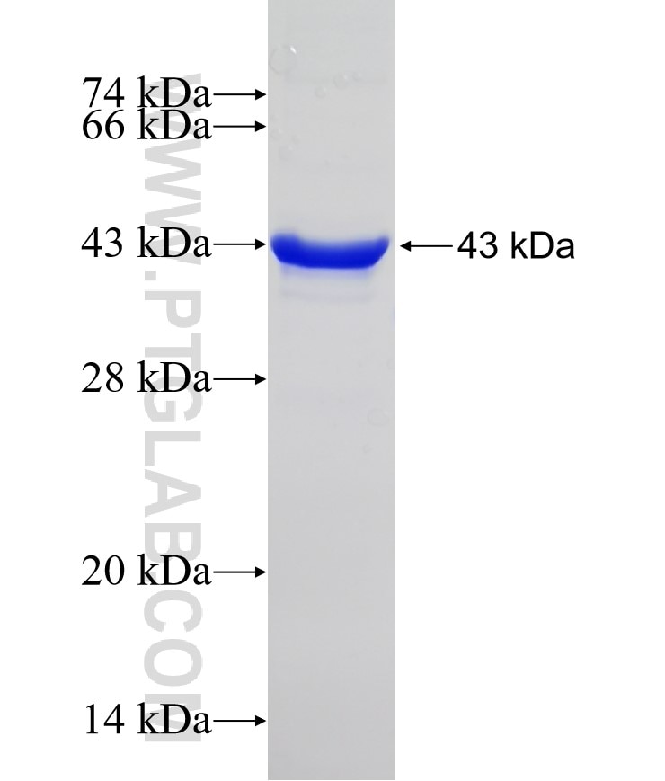 ALK,CD246 fusion protein Ag21493 SDS-PAGE