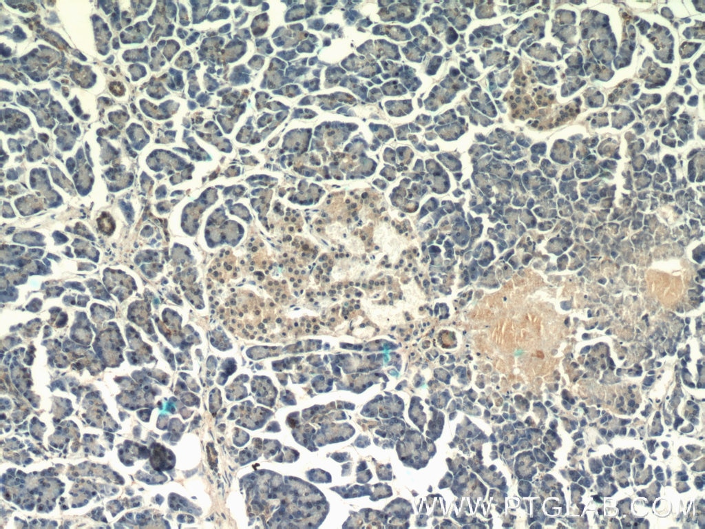 Immunohistochemistry (IHC) staining of human pancreas tissue using ALKBH1 Polyclonal antibody (13234-1-AP)