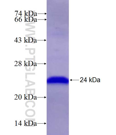 ALKBH1 fusion protein Ag27471 SDS-PAGE