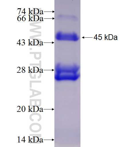 ALKBH1 fusion protein Ag27520 SDS-PAGE