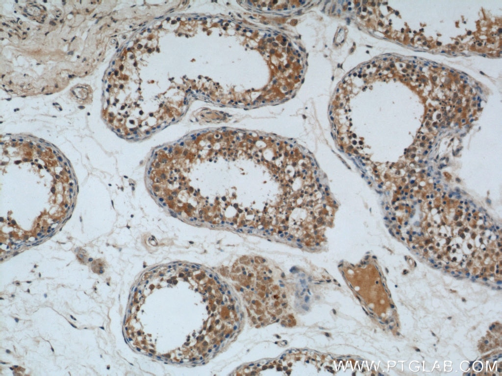 Immunohistochemistry (IHC) staining of human testis tissue using ALKBH3 Polyclonal antibody (12292-1-AP)