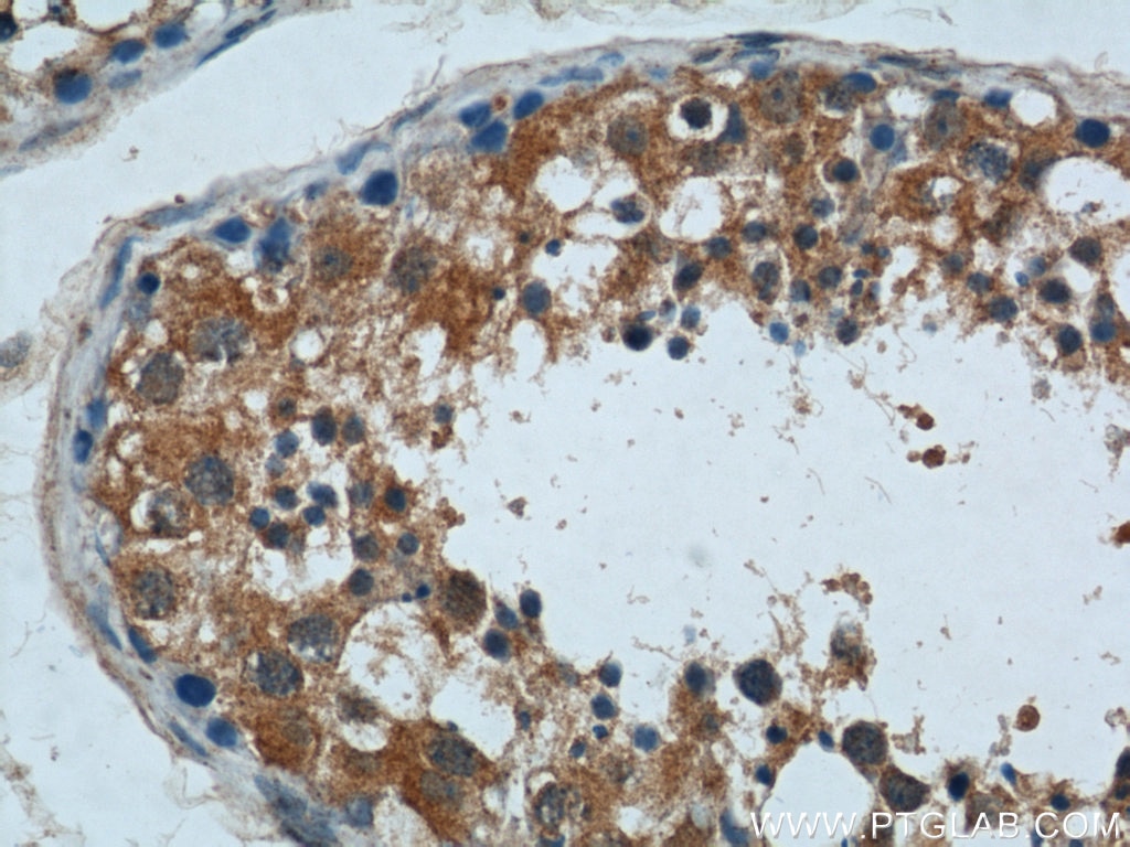 Immunohistochemistry (IHC) staining of human testis tissue using ALKBH3 Polyclonal antibody (12292-1-AP)