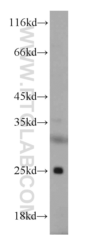 WB analysis of mouse kidney using 12292-1-AP