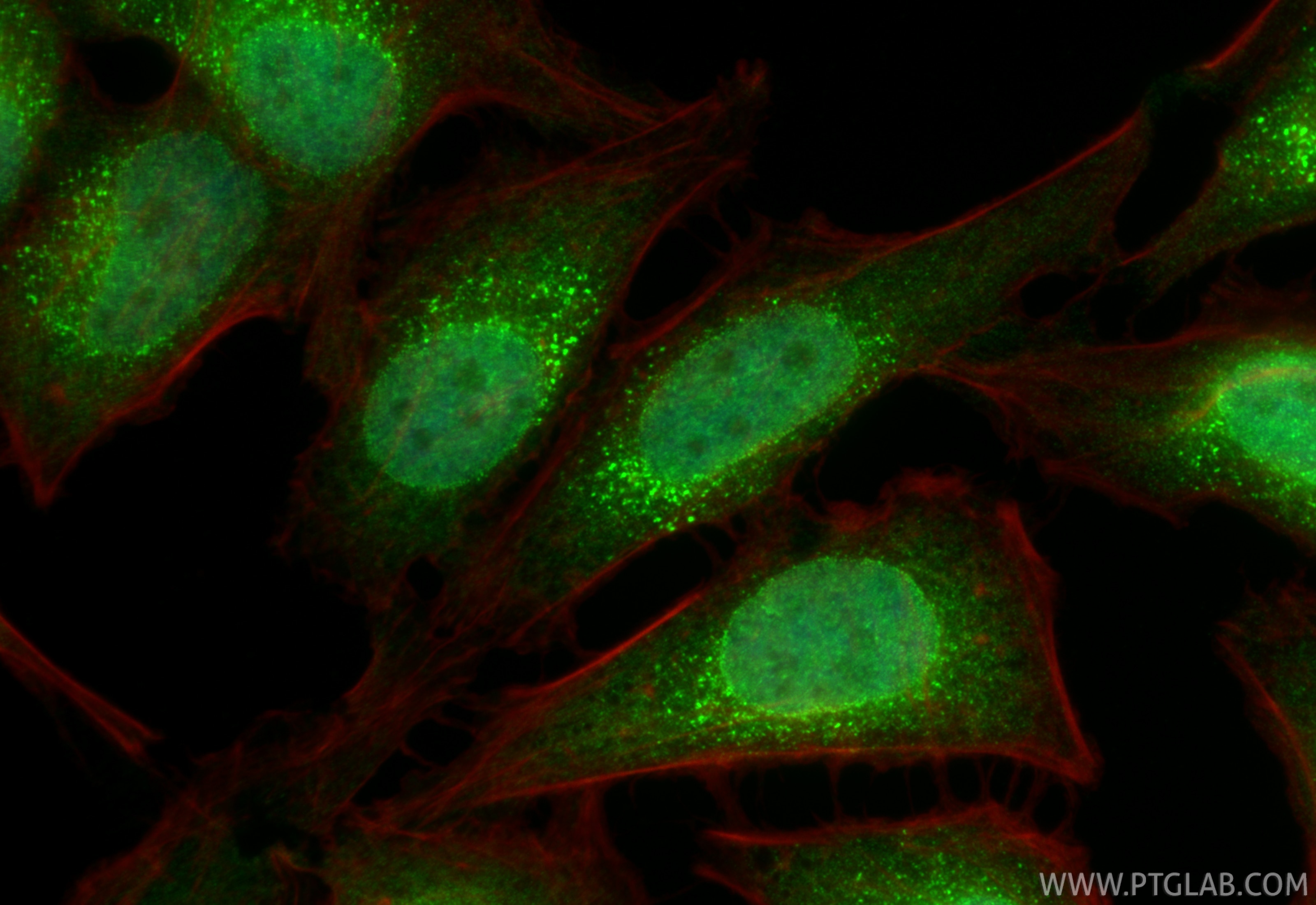 Immunofluorescence (IF) / fluorescent staining of HeLa cells using ALKBH3 Recombinant monoclonal antibody (84314-2-RR)