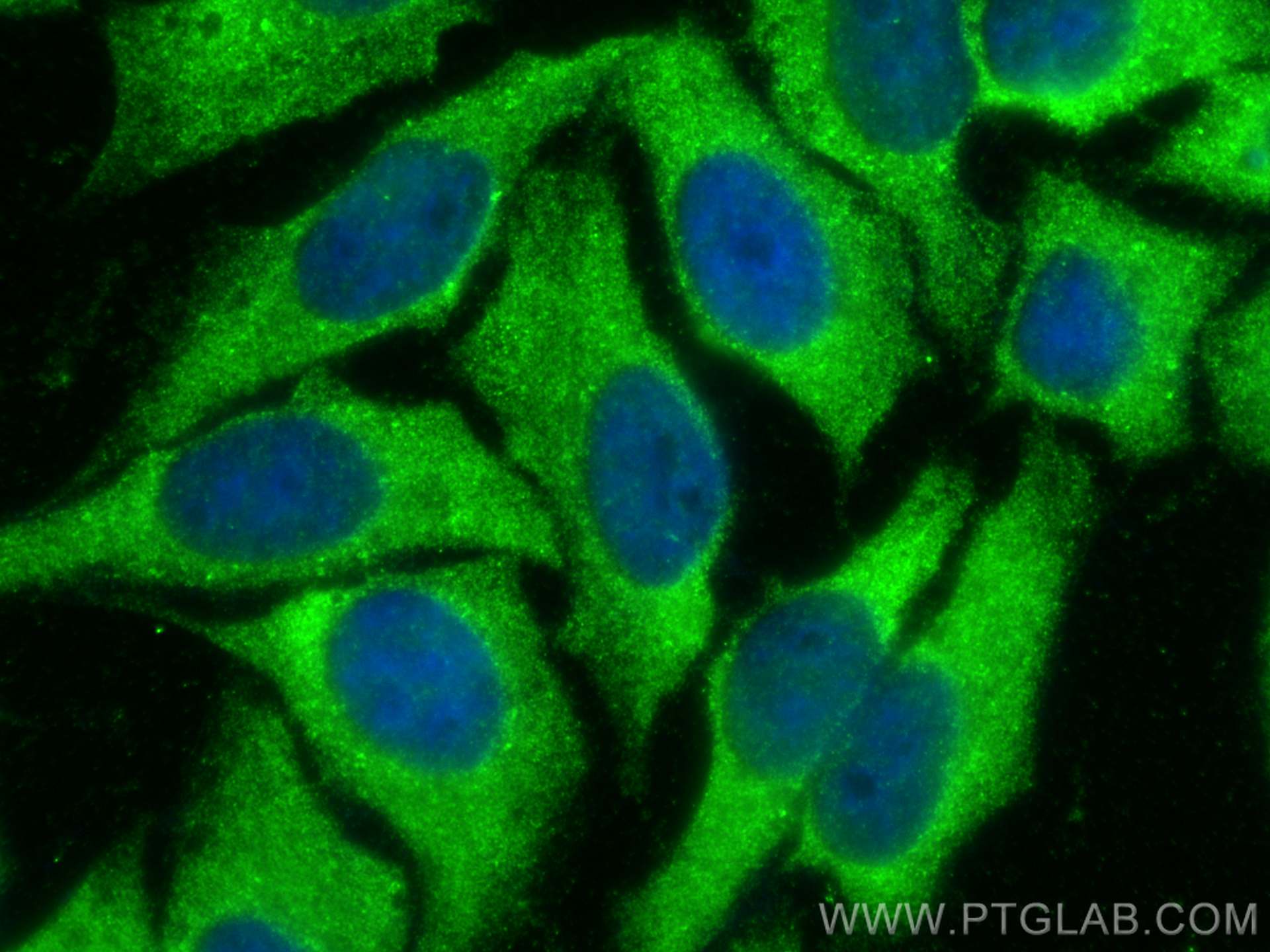 IF Staining of HepG2 using 19882-1-AP