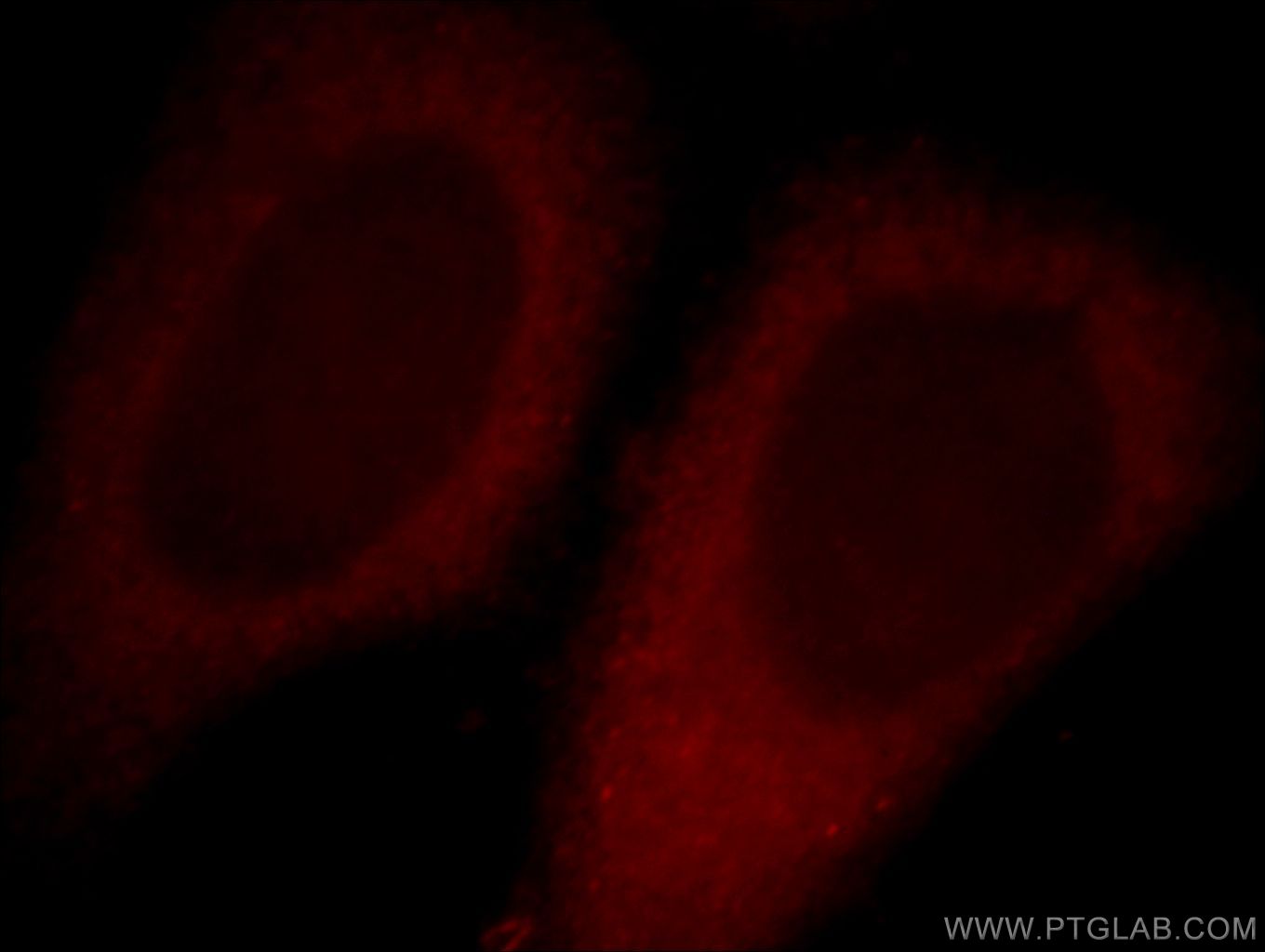 Immunofluorescence (IF) / fluorescent staining of HepG2 cells using ALKBH4 Polyclonal antibody (19882-1-AP)