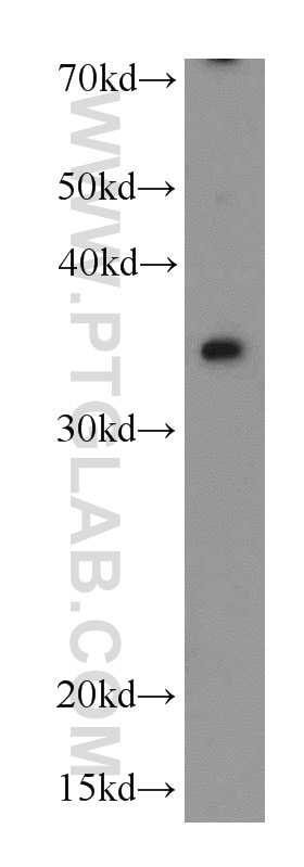 Western Blot (WB) analysis of MCF-7 cells using ALKBH4 Polyclonal antibody (19882-1-AP)