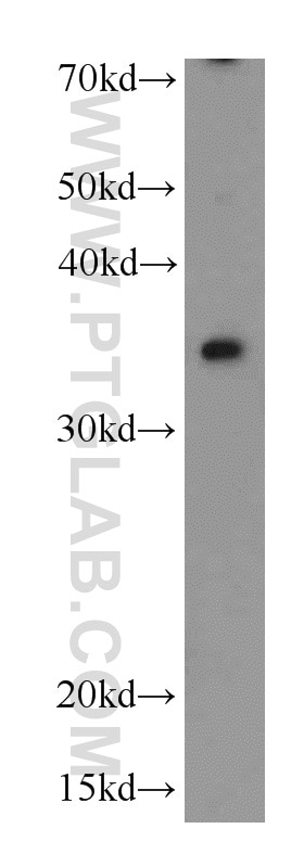 WB analysis of MCF-7 using 19882-1-AP