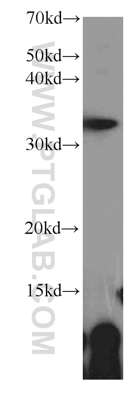 Western Blot (WB) analysis of K-562 cells using ALKBH4 Polyclonal antibody (19882-1-AP)