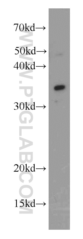 Western Blot (WB) analysis of mouse kidney tissue using ALKBH4 Polyclonal antibody (19882-1-AP)