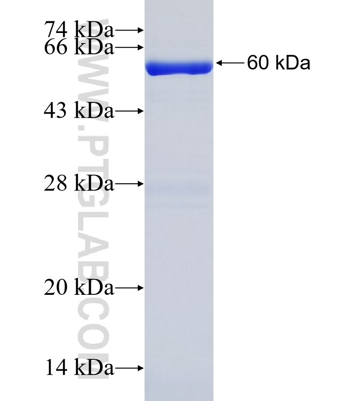 ALKBH4 fusion protein Ag7764 SDS-PAGE