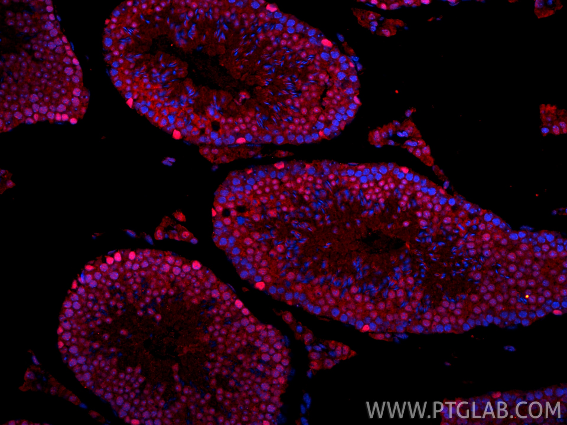 Immunofluorescence (IF) / fluorescent staining of mouse testis tissue using ALKBH5 Polyclonal antibody (16837-1-AP)