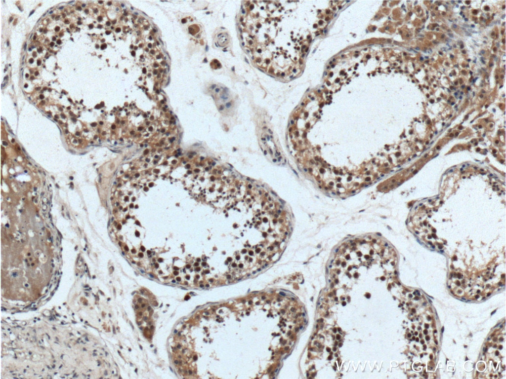 Immunohistochemistry (IHC) staining of human testis tissue using ALKBH5 Polyclonal antibody (16837-1-AP)