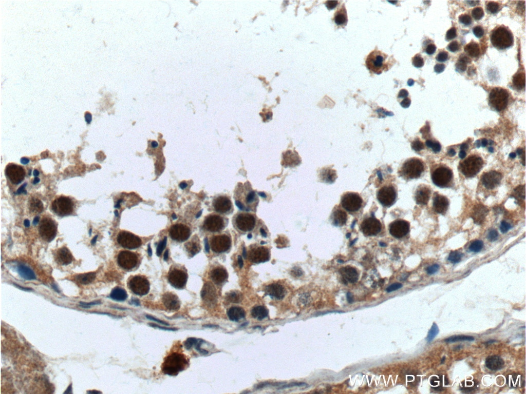 Immunohistochemistry (IHC) staining of human testis tissue using ALKBH5 Polyclonal antibody (16837-1-AP)