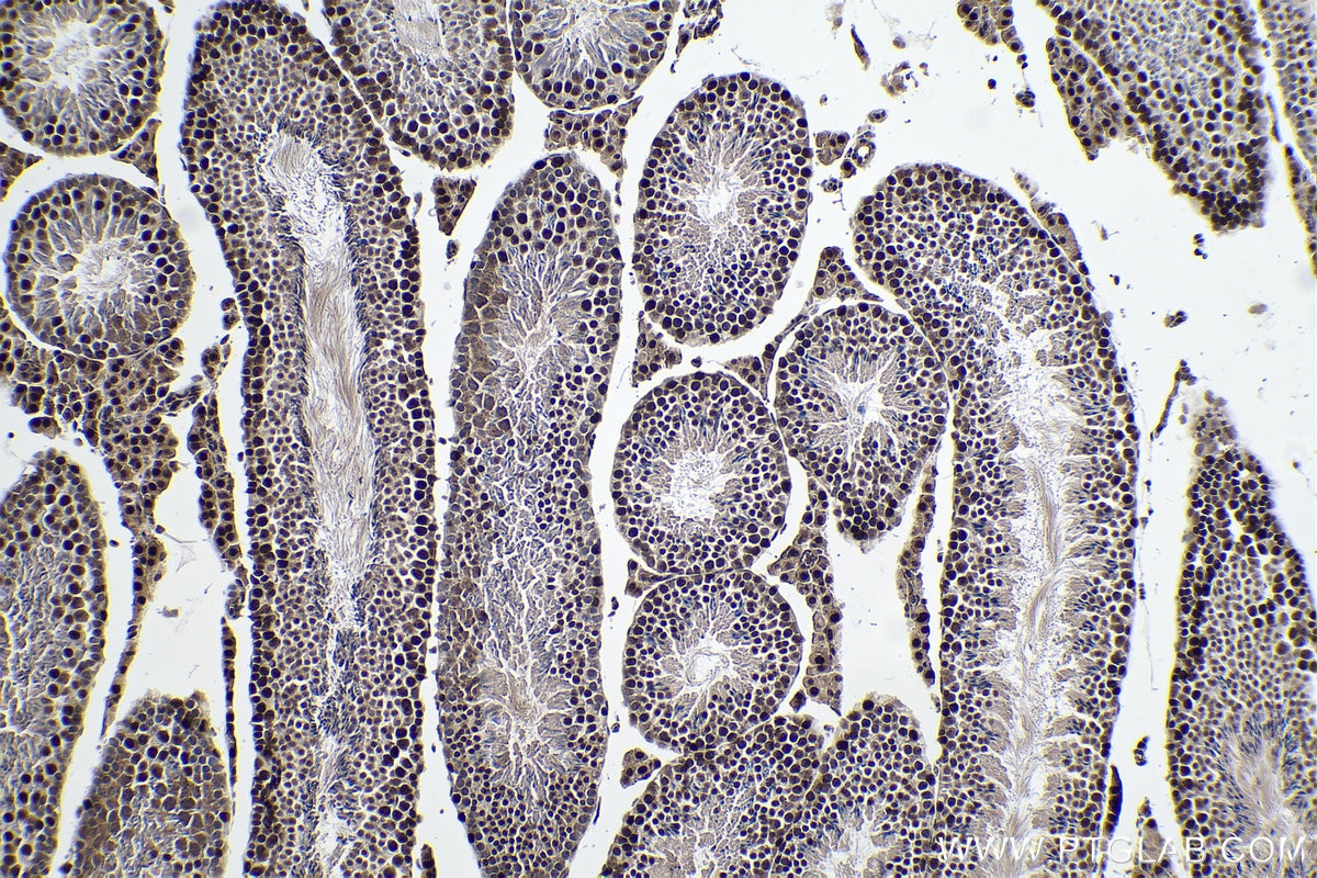 Immunohistochemistry (IHC) staining of mouse testis tissue using ALKBH5 Monoclonal antibody (67811-1-Ig)