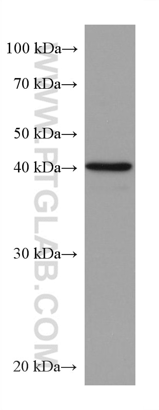 Western Blot (WB) analysis of Jurkat cells using ALKBH5 Monoclonal antibody (67811-1-Ig)