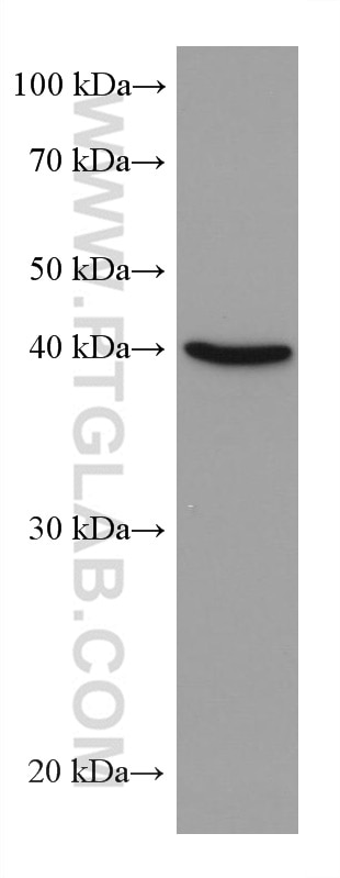 WB analysis of K-562 using 67811-1-Ig