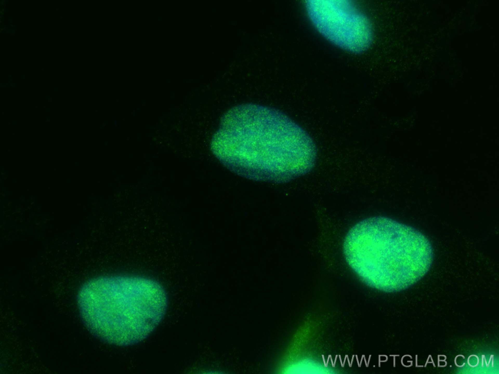 Immunofluorescence (IF) / fluorescent staining of U-251 cells using ALKBH5 Recombinant antibody (82083-1-RR)