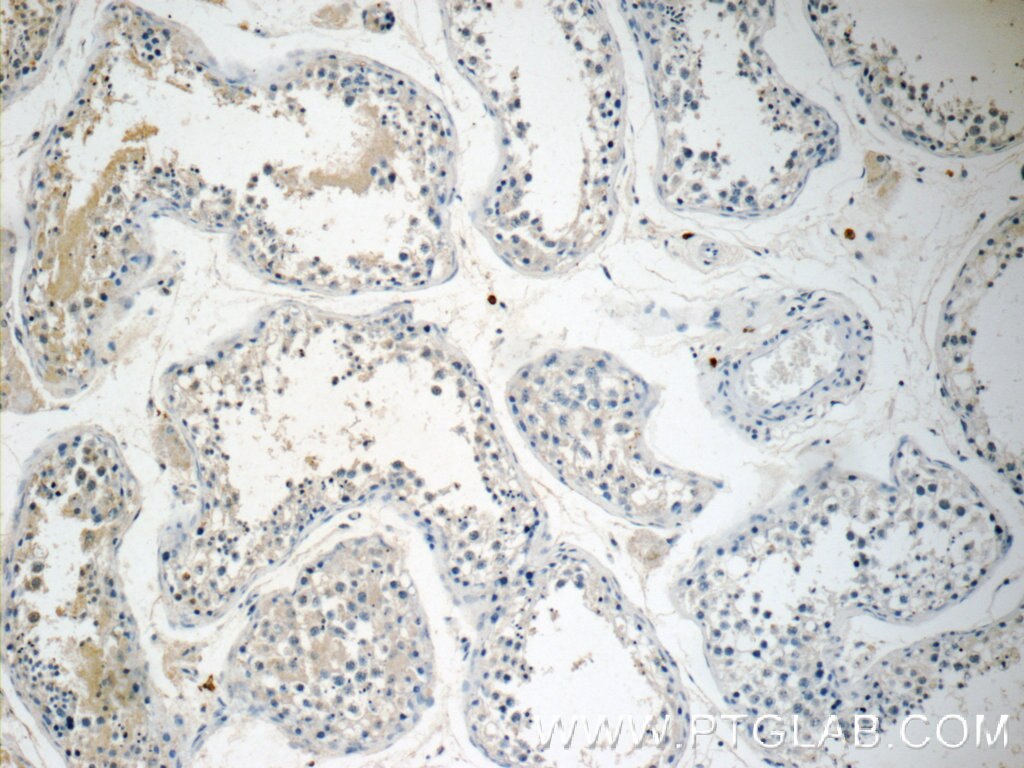 Immunohistochemistry (IHC) staining of human testis tissue using ALKBH7 Polyclonal antibody (15470-1-AP)