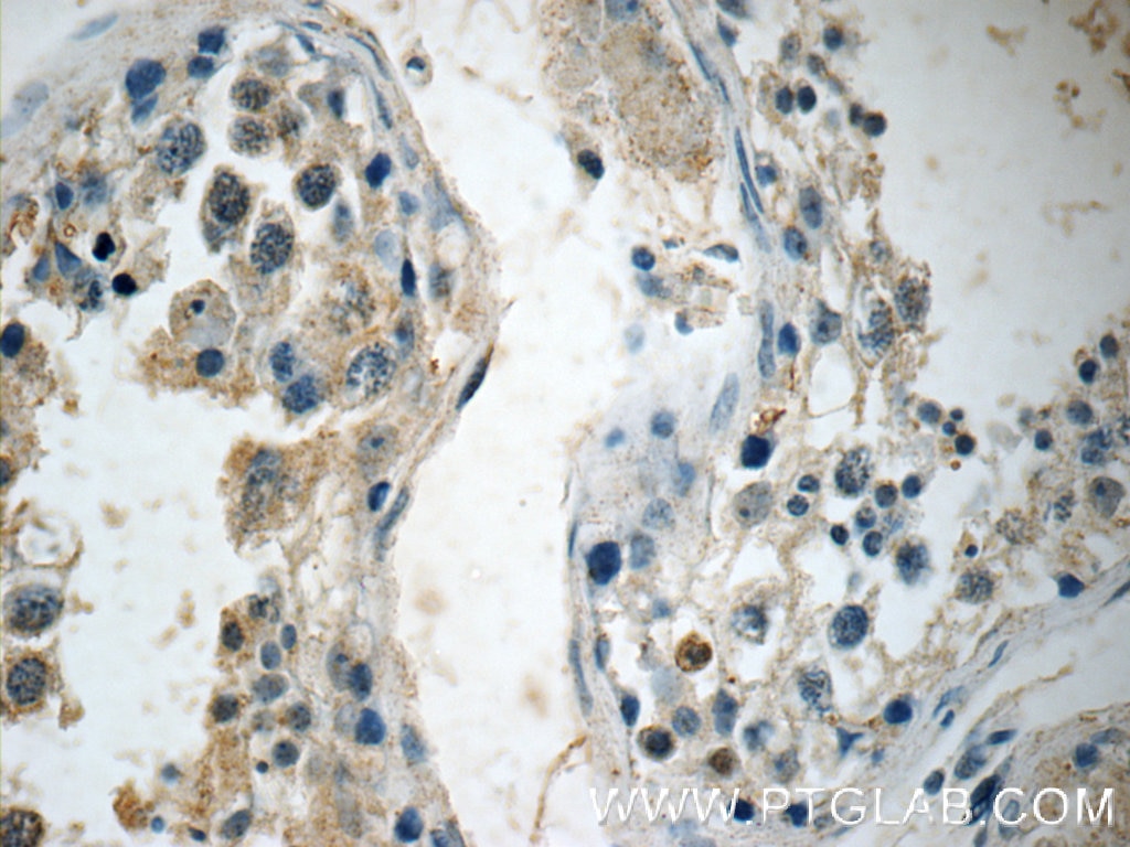Immunohistochemistry (IHC) staining of human testis tissue using ALKBH7 Polyclonal antibody (15470-1-AP)