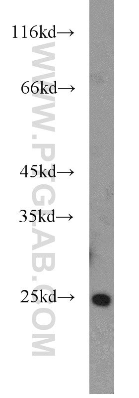 Western Blot (WB) analysis of human testis tissue using ALKBH7 Polyclonal antibody (15470-1-AP)