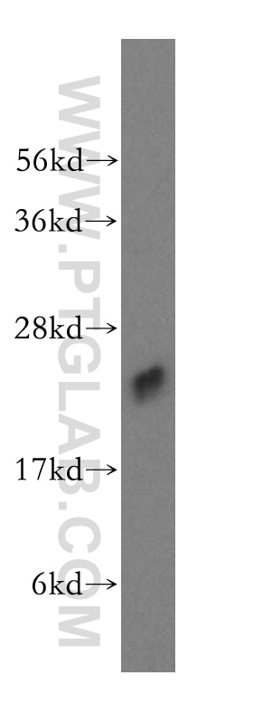 Western Blot (WB) analysis of human testis tissue using ALKBH7 Polyclonal antibody (15470-1-AP)