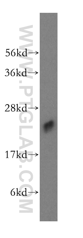 WB analysis of human testis using 15470-1-AP