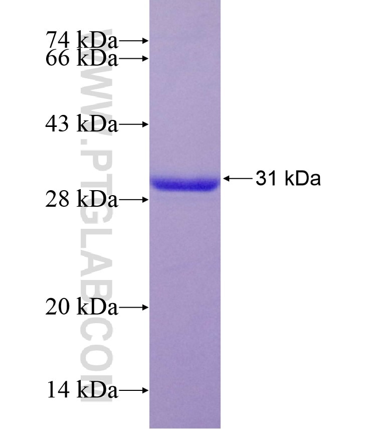 ALKBH7 fusion protein Ag7624 SDS-PAGE