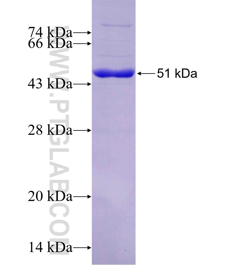 ALKBH7 fusion protein Ag7772 SDS-PAGE