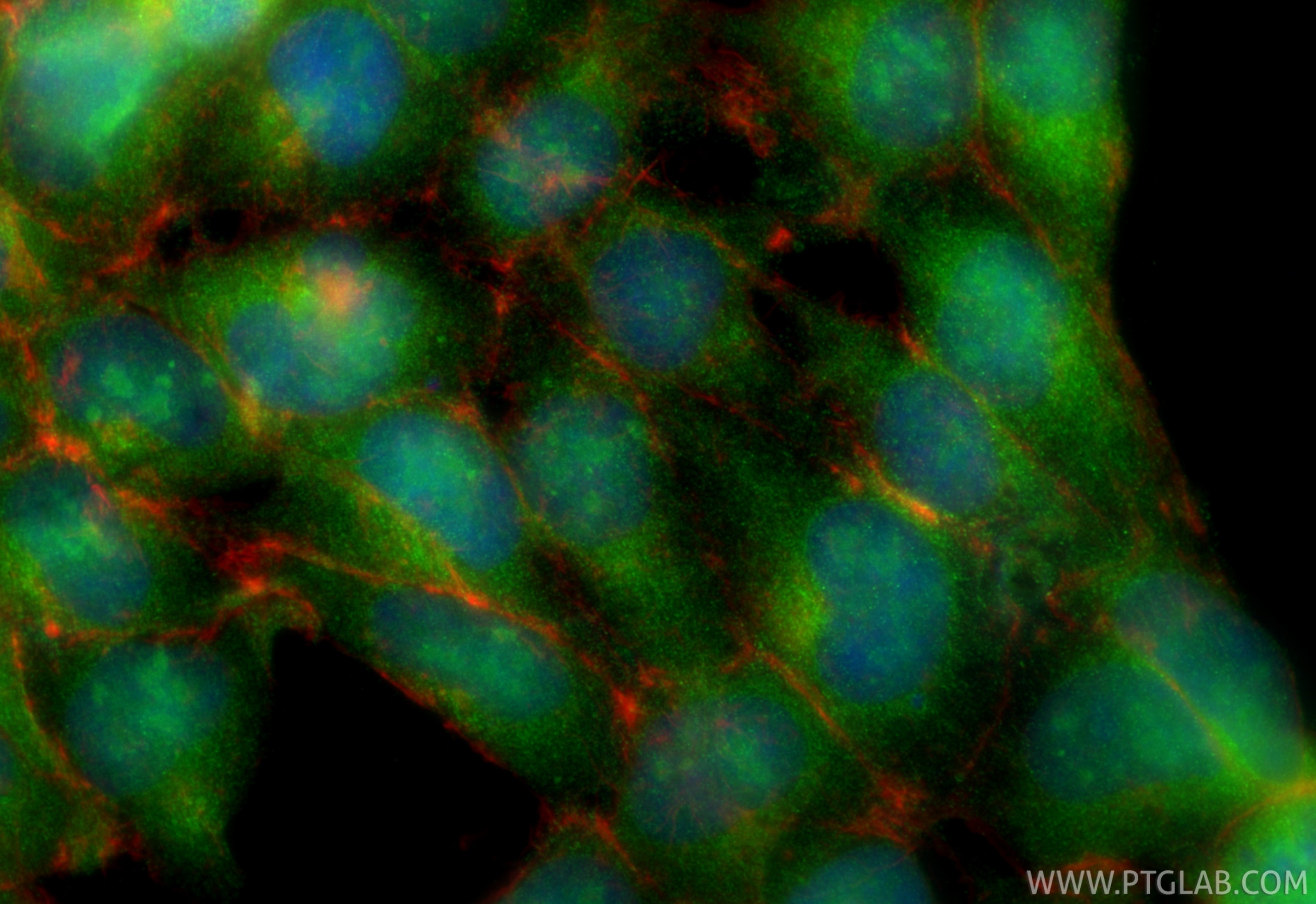 Immunofluorescence (IF) / fluorescent staining of HEK-293 cells using ALKBH8 Polyclonal antibody (25566-1-AP)