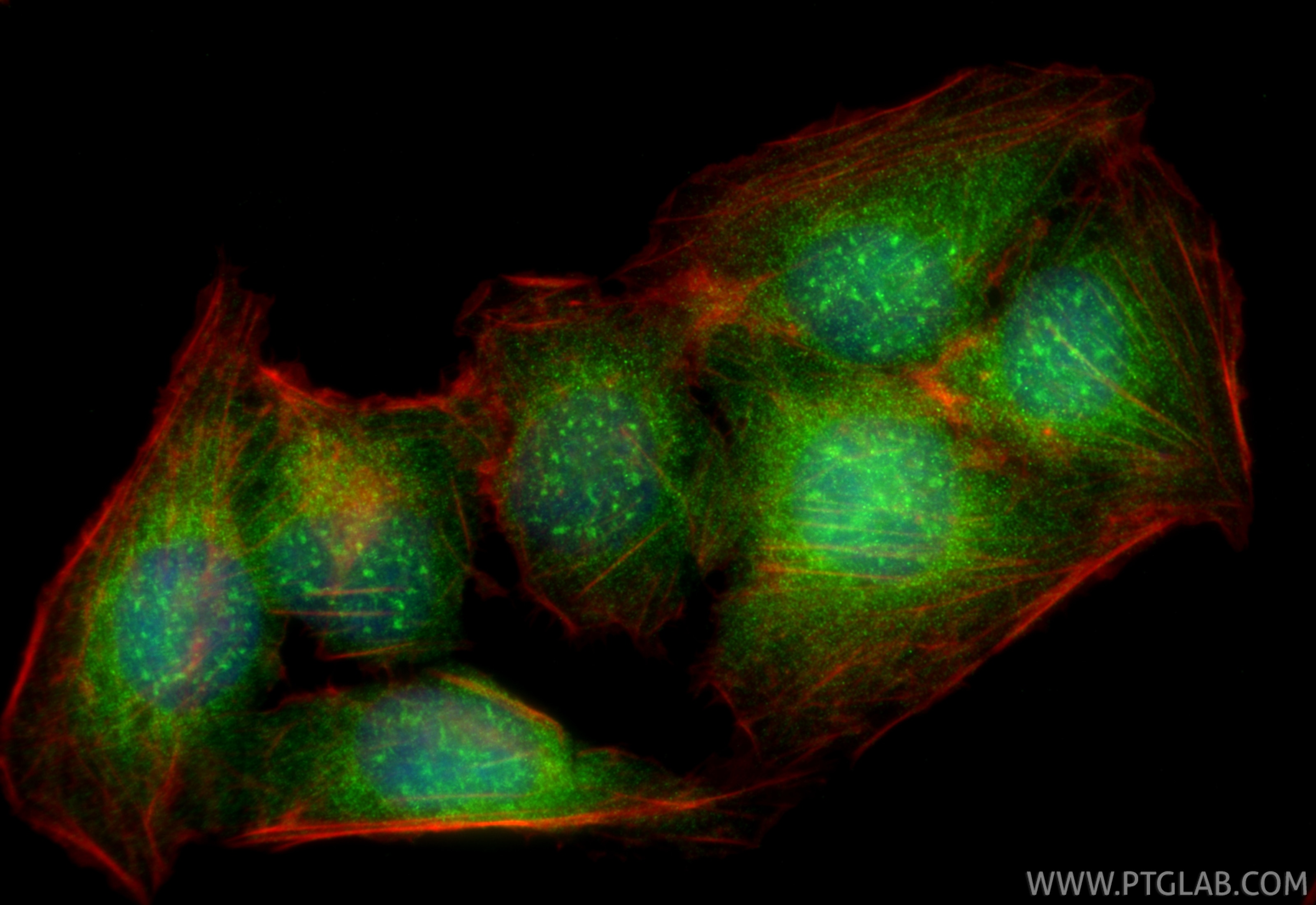 Immunofluorescence (IF) / fluorescent staining of U2OS cells using ALKBH8 Polyclonal antibody (25566-1-AP)