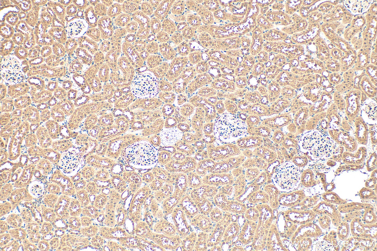 Immunohistochemistry (IHC) staining of rat kidney tissue using ALKBH8 Polyclonal antibody (25566-1-AP)