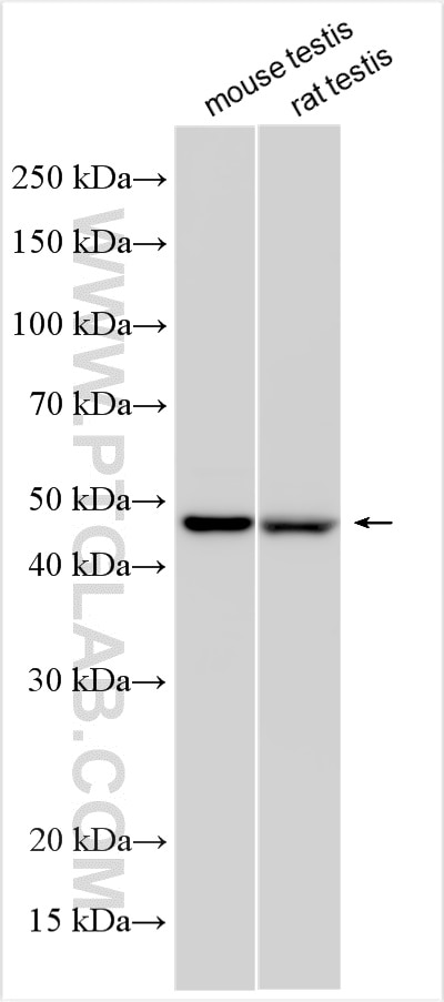 Western Blot (WB) analysis of various lysates using ALLC Polyclonal antibody (31222-1-AP)