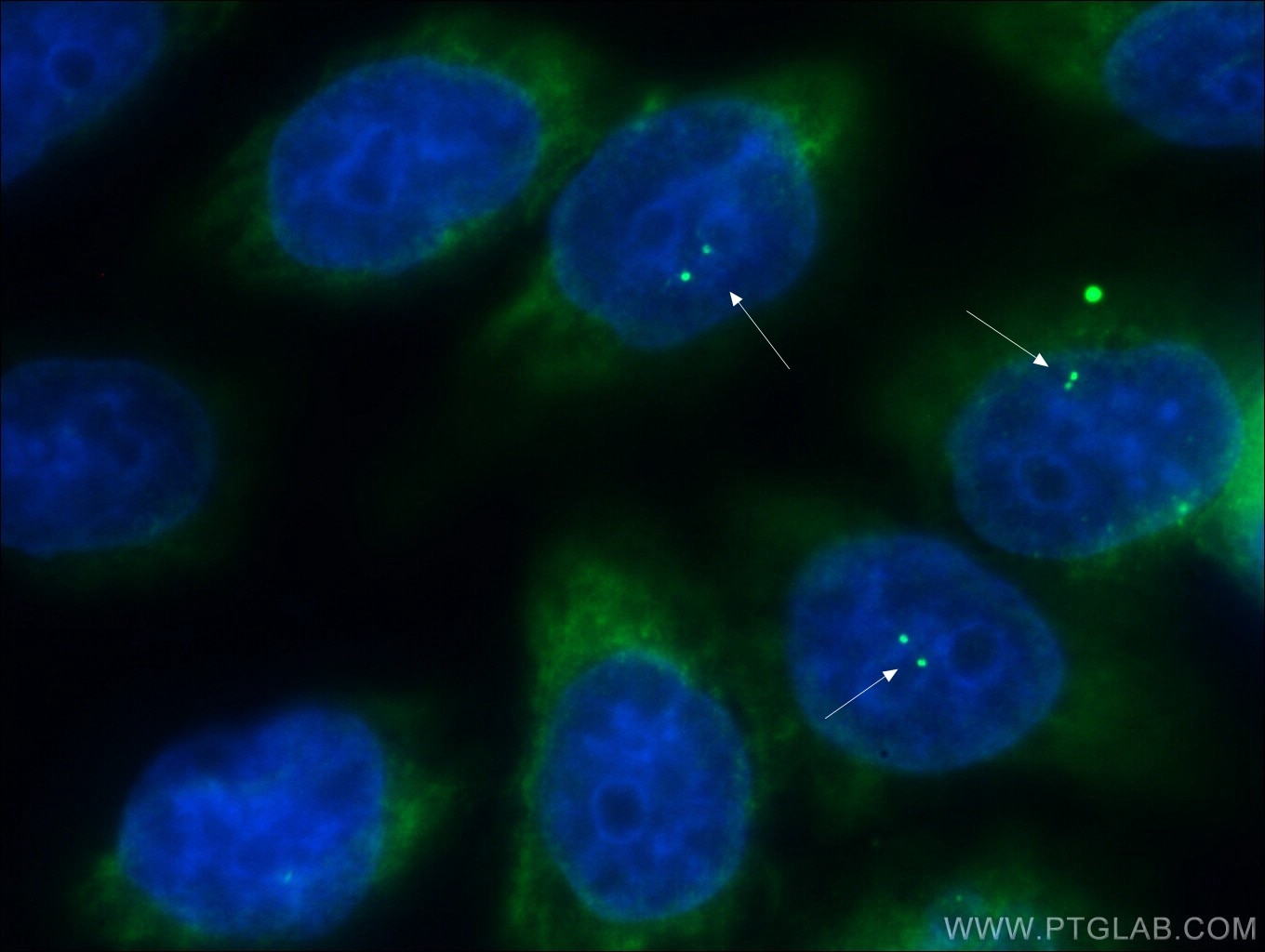 Immunofluorescence (IF) / fluorescent staining of HeLa cells using ALMS1 Polyclonal antibody (27231-1-AP)