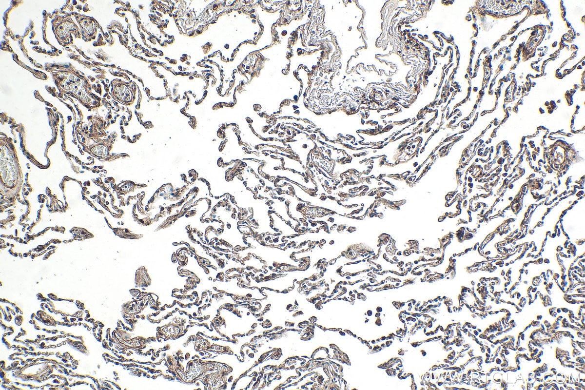 Immunohistochemical analysis of paraffin-embedded human lung tissue slide using 27231-1-AP (ALMS1 antibody) at dilution of 1:200 (under 10x lens). Heat mediated antigen retrieval with Tris-EDTA buffer (pH 9.0). Immunohistochemistry (IHC) staining of human lung tissue using ALMS1 Polyclonal antibody (27231-1-AP)