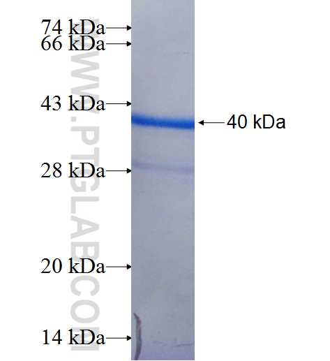 ALMS1 fusion protein Ag26100 SDS-PAGE