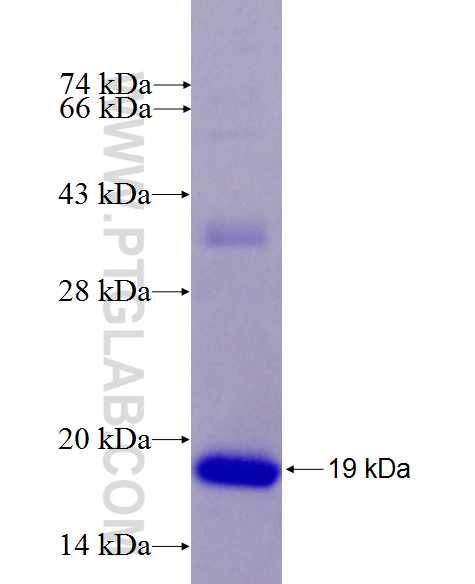 ALOX12 fusion protein Ag26648 SDS-PAGE