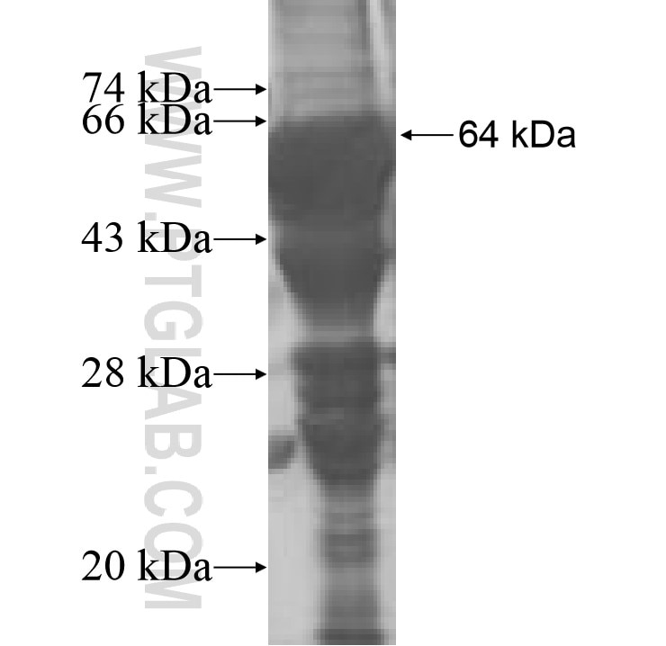 ALOX12B fusion protein Ag9852 SDS-PAGE