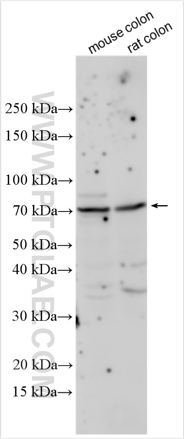 Western Blot (WB) analysis of various lysates using ALOX15 Polyclonal antibody (13286-1-AP)