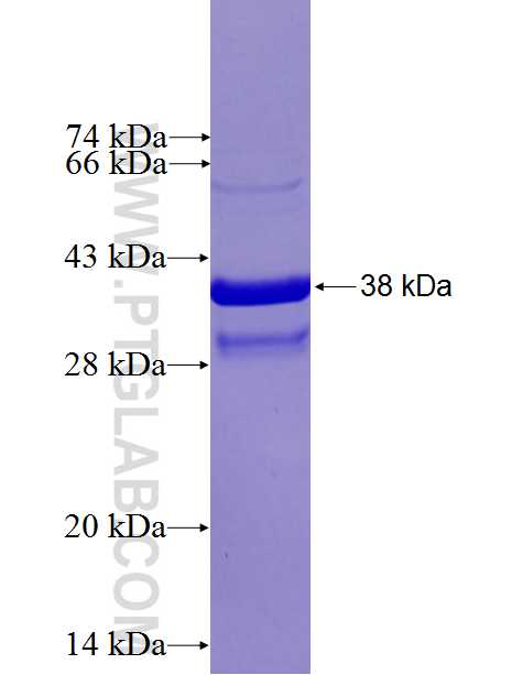ALOX15 fusion protein Ag27215 SDS-PAGE
